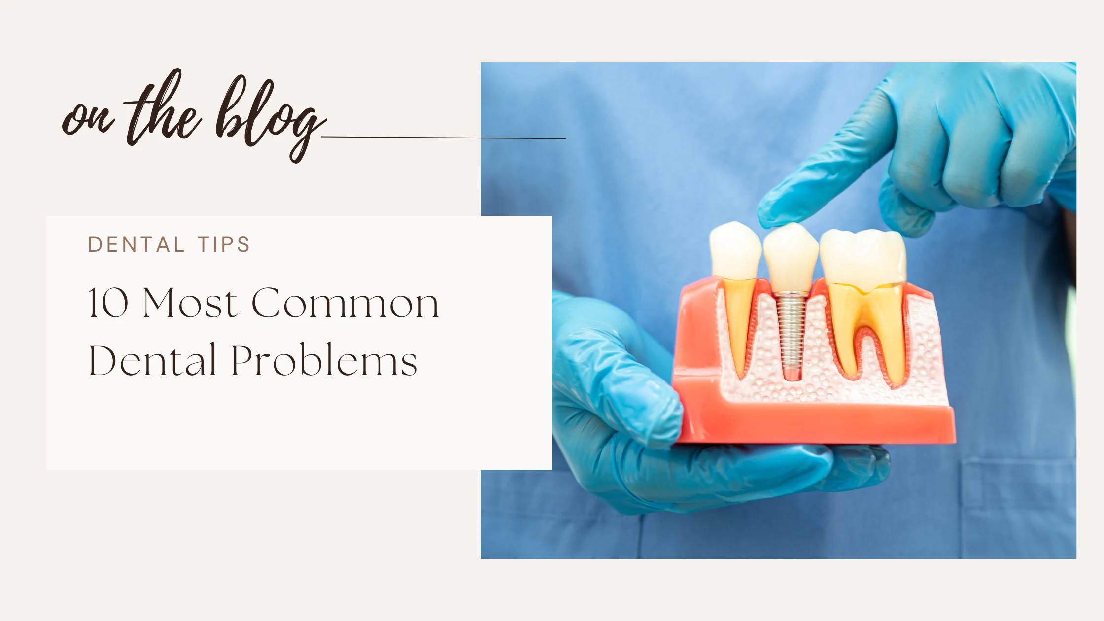 10 Common Dental Problems